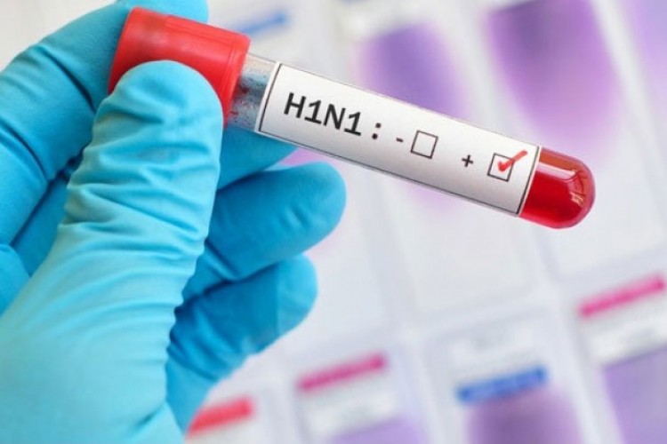 Pacijent u BiH preminuo od virusa H1N1