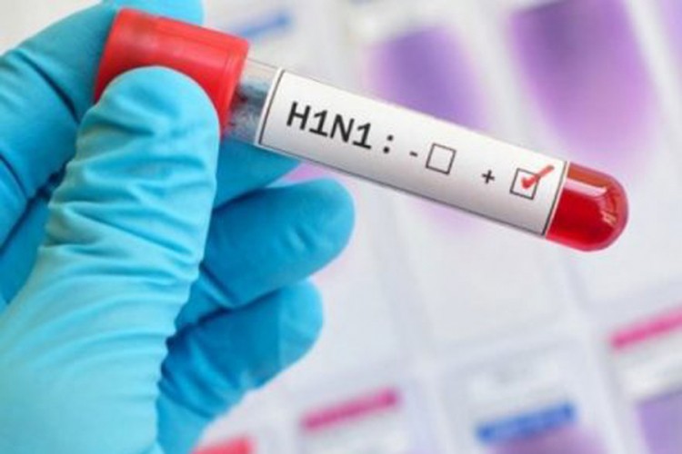 Djevojka iz Srbije preminula u Bahreinu od virusa H1N1