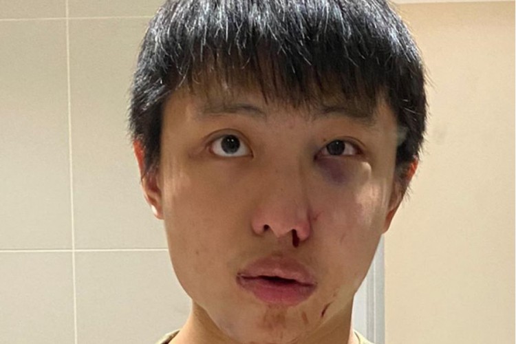 Student iz Azije pretučen u Londonu: Ne želimo tvoj korona virus