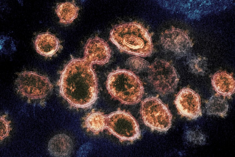 Naučnici: Virus korona nije vještački izazvan