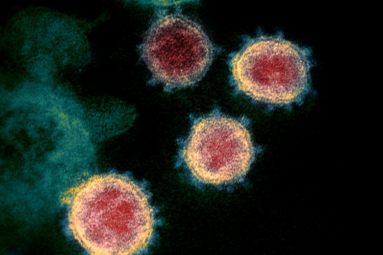 Ruski ljekar otkrio zašto su virusi poput Kovid-19 posebni