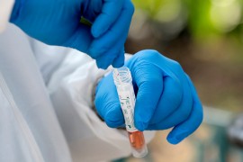 U Srpskoj novih 11 slučajeva zaraze virusom korona