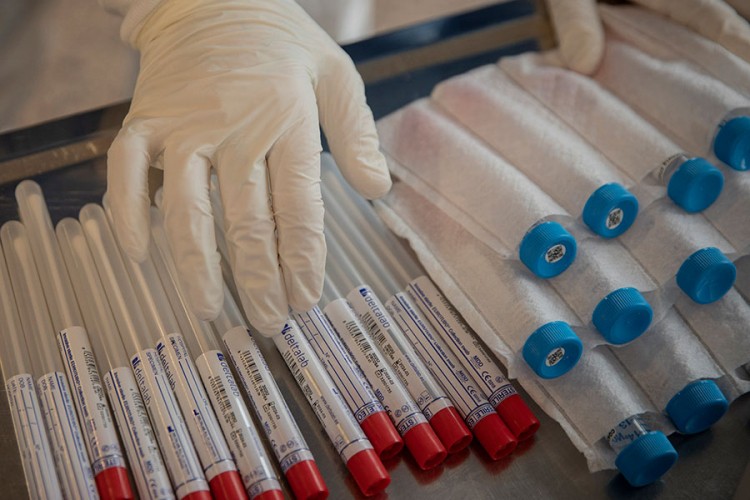 Bečki naučnici testiraju lijek protiv virusa korona