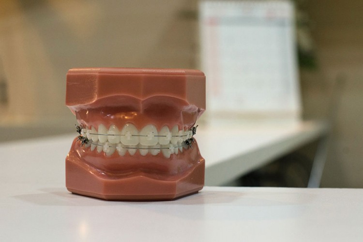 Vic dana: Kod zubara