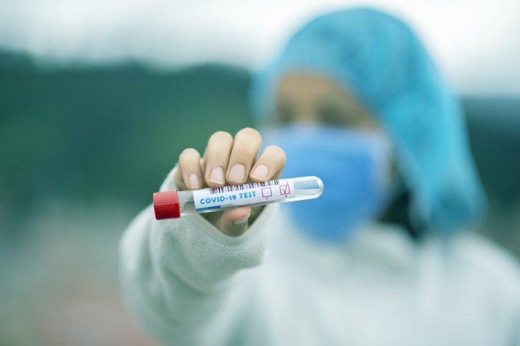 Naučnici: Ne možete dva puta biti zaraženi virusom korona