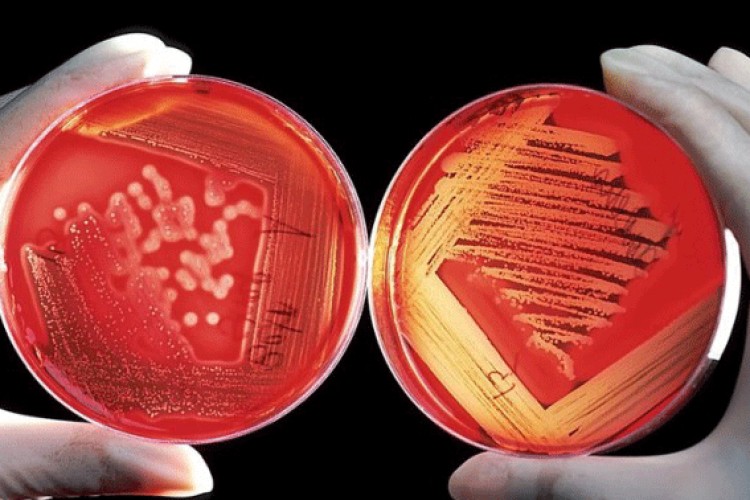Naučnici uspjeli da proizvedu vještačka crvena krvna zrnca – hoće li nam to biti od pomoći