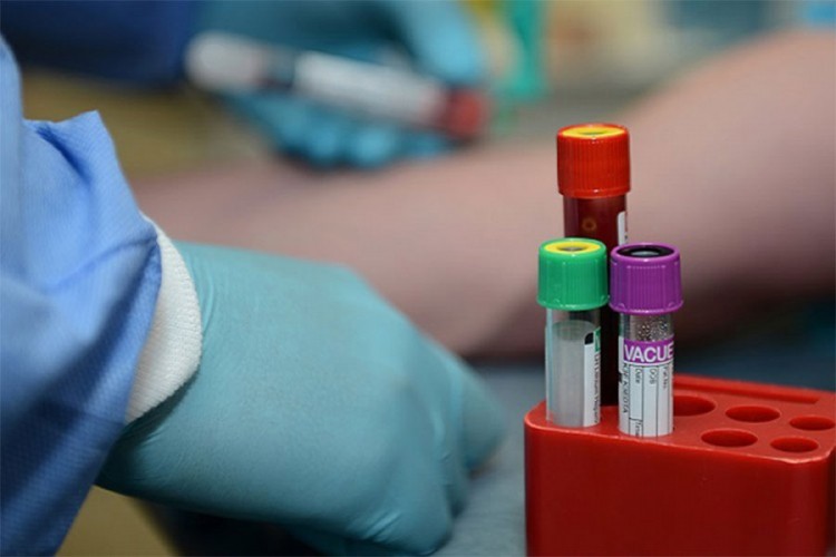 Jedna osoba preminula, 22 novozaraženih virusom korona u RS