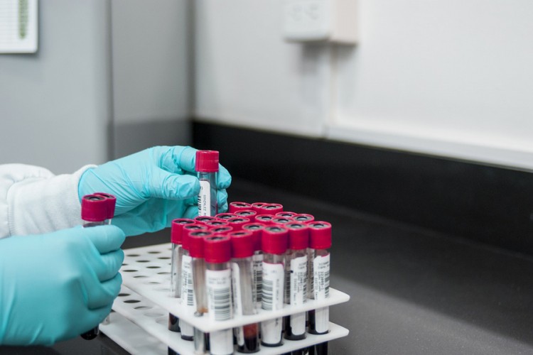 Zašto Njemačka ne priznaje PCR test urađen u BiH?