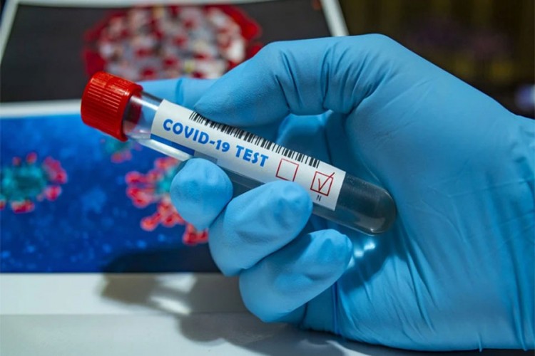 Njemačka priznaje PCR testove iz BiH