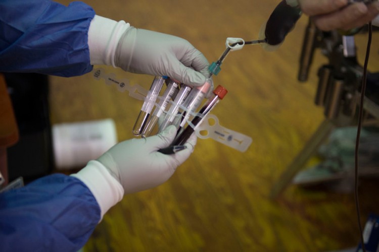 U Hrvatskoj počinje prikupljanje krvne plazme za liječenje oboljelih