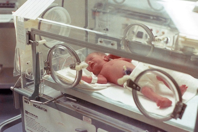 Šta čuju bebe u inkubatoru - da li je buka jača od usisivača