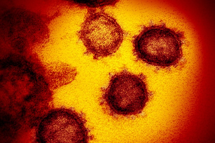 Žena bez simptoma virusom korona zarazila skoro 100 osoba?