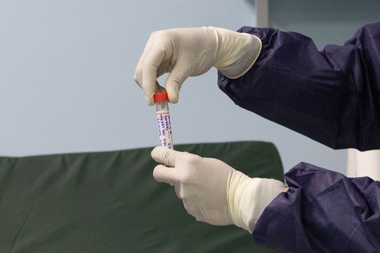 U Srpskoj od virusa korona preminule tri osobe, 130 novozaraženih