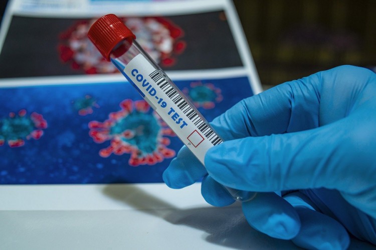 U FBiH potvrđeno 125 novih slučajeva zaraze virusom korona