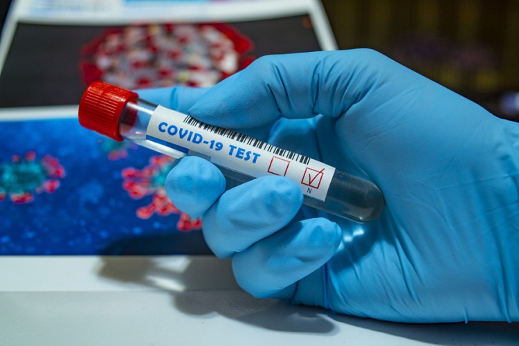 U Srpskoj od danas jeftiniji komercijalni testovi na virus korona