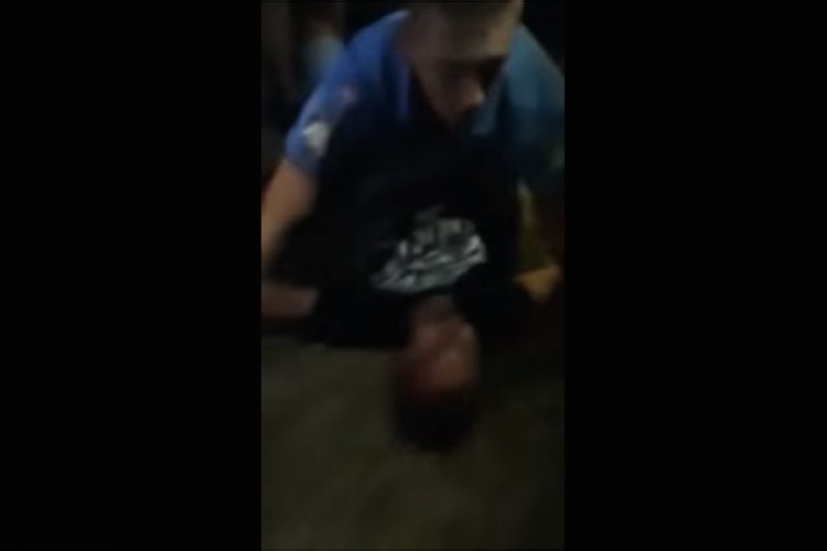 Policajac u Zadru brutalno prebio mladića zbog ekavice?