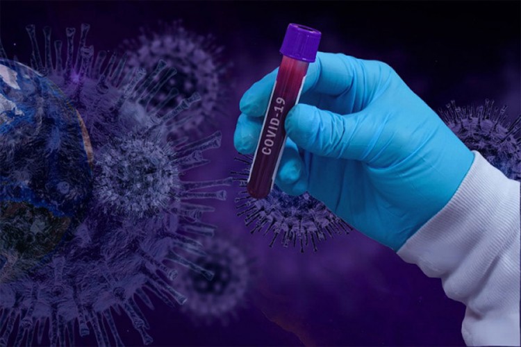 U Francuskoj naglo opada broj zaraženih virusom korona
