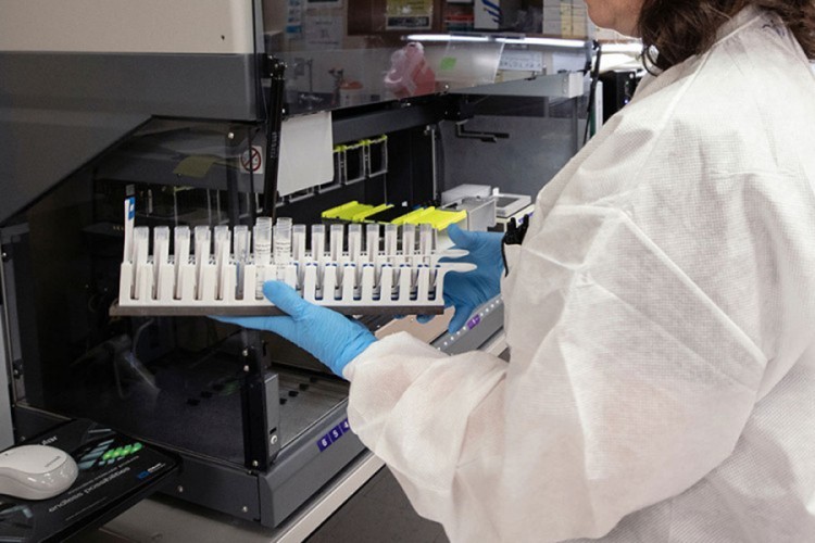 KCUS: Testirano 337 uzoraka, virus potvrđen kod 49 osoba