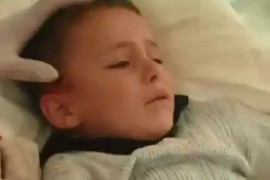 Potresan snimak iz Nagorno-Karabaha: Dječaku vade geler iz glave