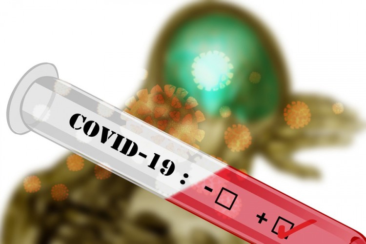Teška veče na KCUS-u: Još 137 pozitivnih na virus korona