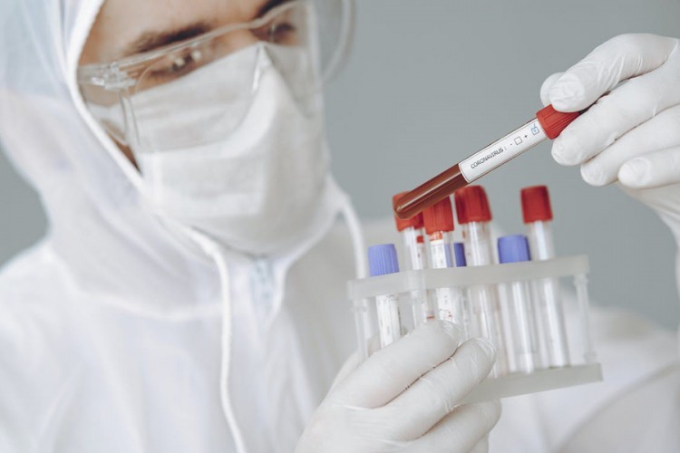 Republika Srpska nabavlja 90.000 PCR testova