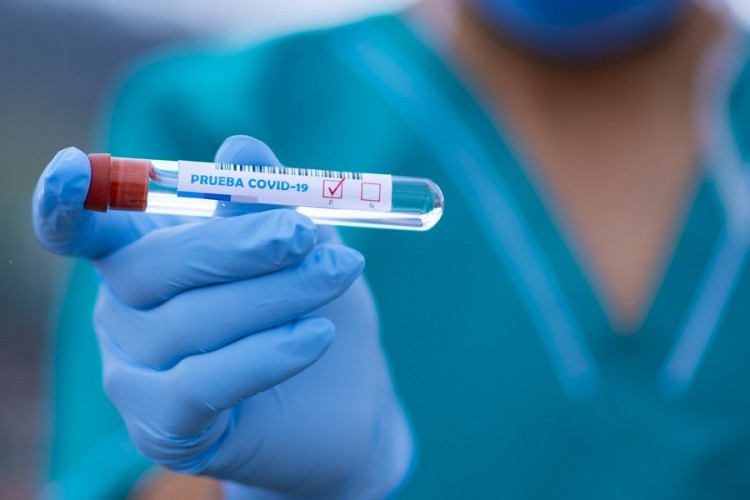 U Hrvatskoj preminulo 70 osoba, još 2.233 zaraženih