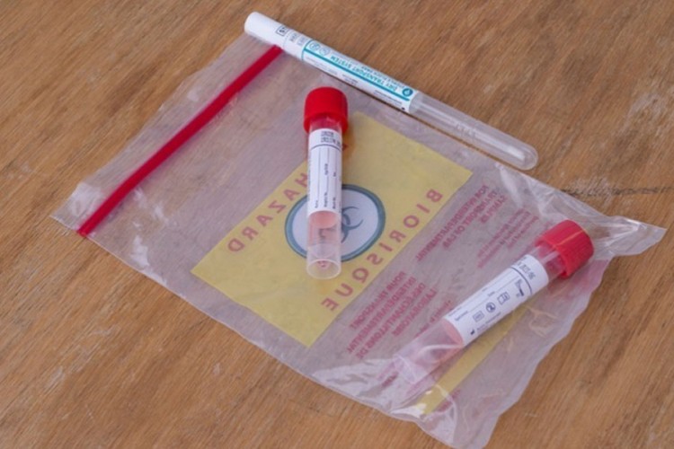 Brzi testovi na kovid i sezonski grip u Dom zdravlja Bijeljina