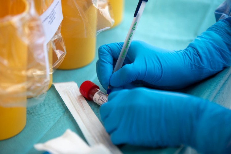 Devet pacijenata preminulo, još 70 pozitivnih na virus korona u Srpskoj