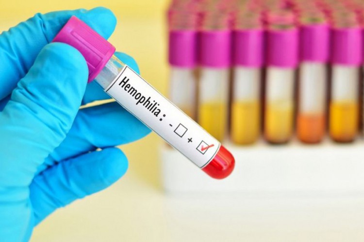 Svjetski dan borbe protiv hemofilije: "Žalosno je što lijeka ima, ali čekamo"