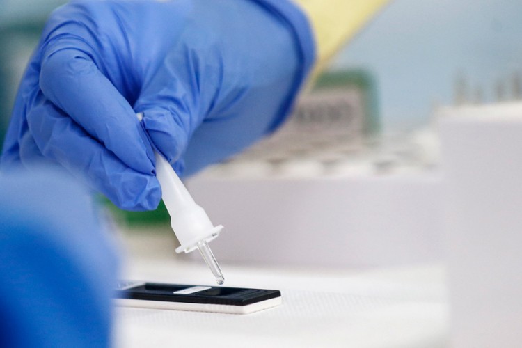 Razvili test pouzdaniji od PCR-a, u timu molekularni biolog iz Srbije