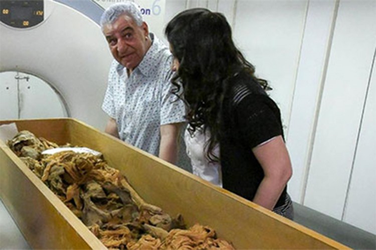 Egipatska mumija u milanskoj bolnici radi otkrivanja tajni