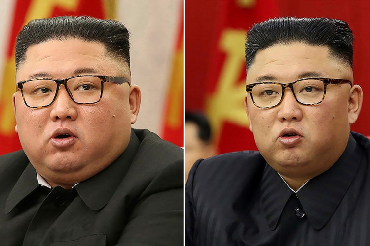 Šta se krije iza vitkijeg izgleda Kim Džong Una?