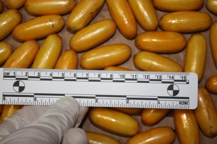 Na "Tuđmanu" pojela 76 paketića droge, iz organizma izbacila kilogram