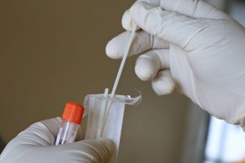 U Turskoj ukinut PCR test na mnogim mjestima