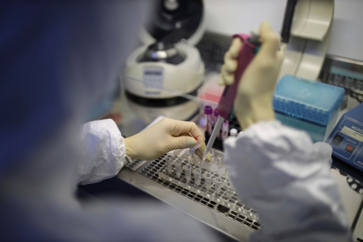 Novi PCR aparat za dijagnostiku virusa korona u Srpskoj