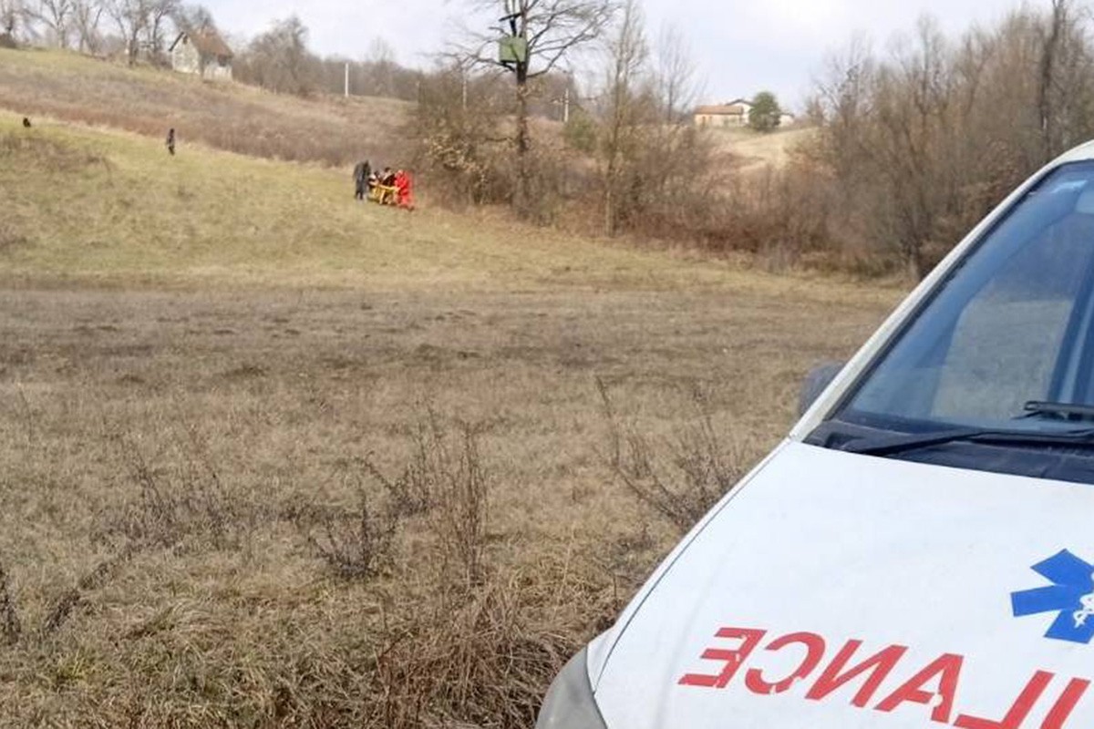 Čobanin preminuo od opekotina