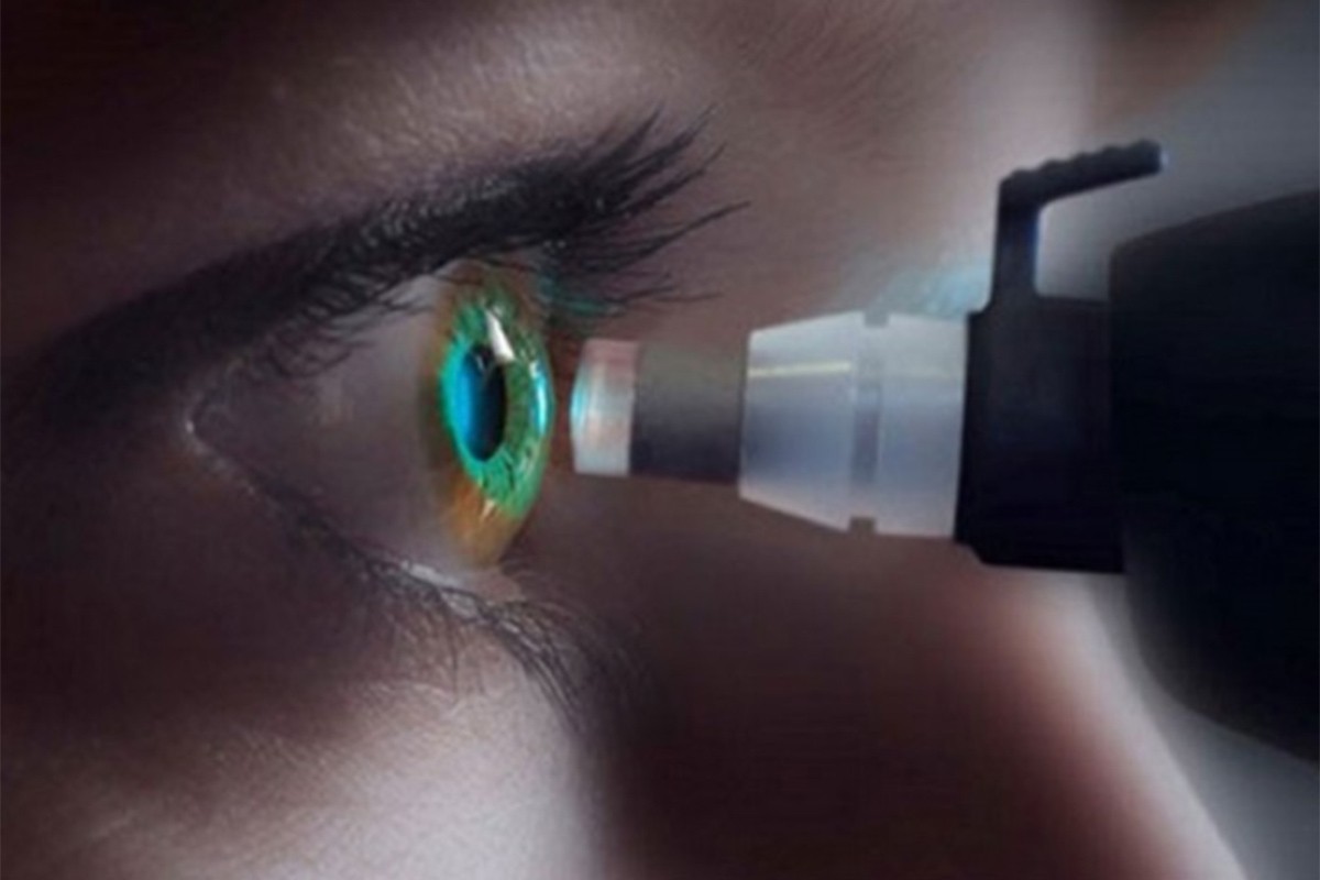 Besplatno mjerenje očnog pritiska u Doboju
