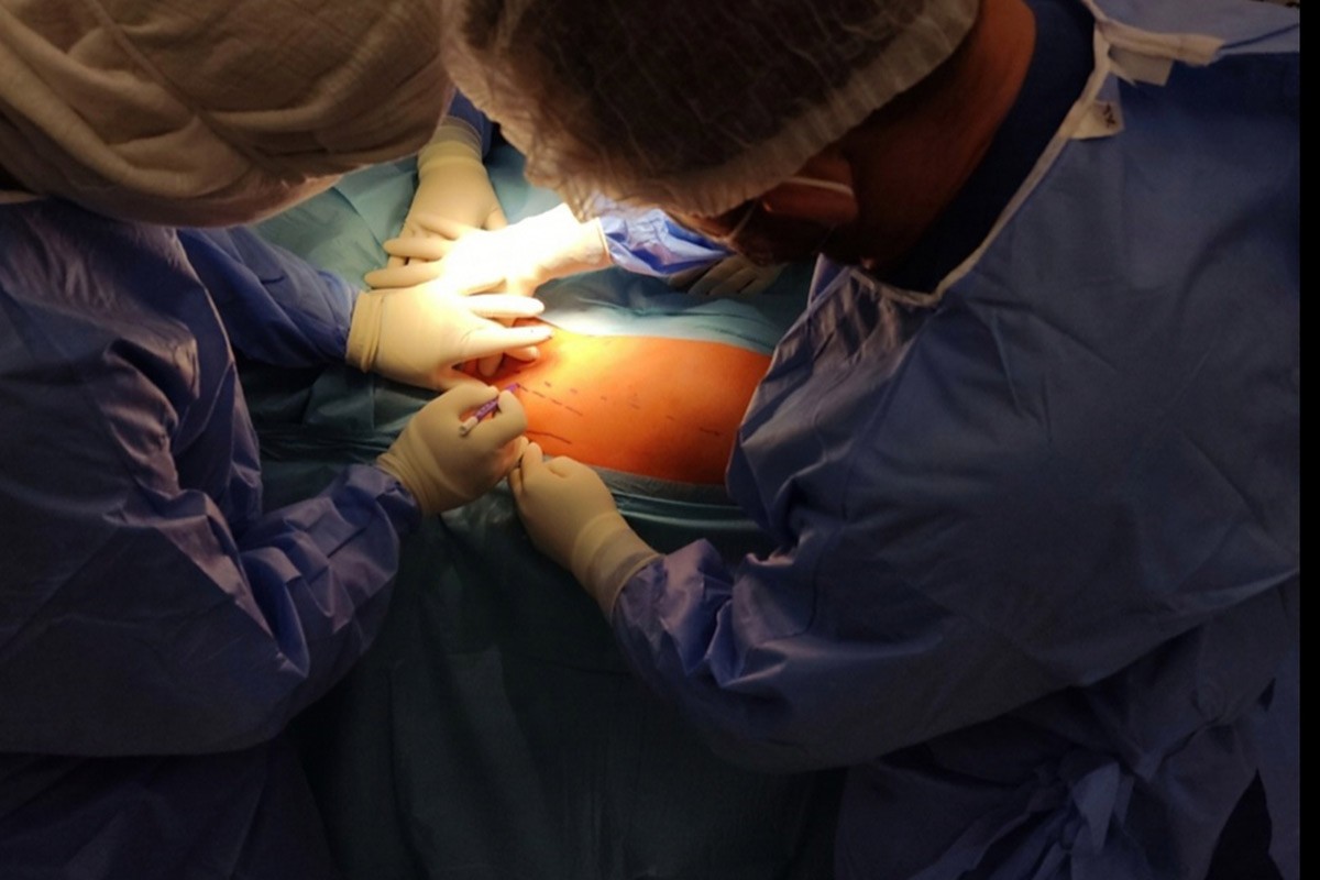 Izvedena minimalno invazivna operacija kuka na UKC-u RS