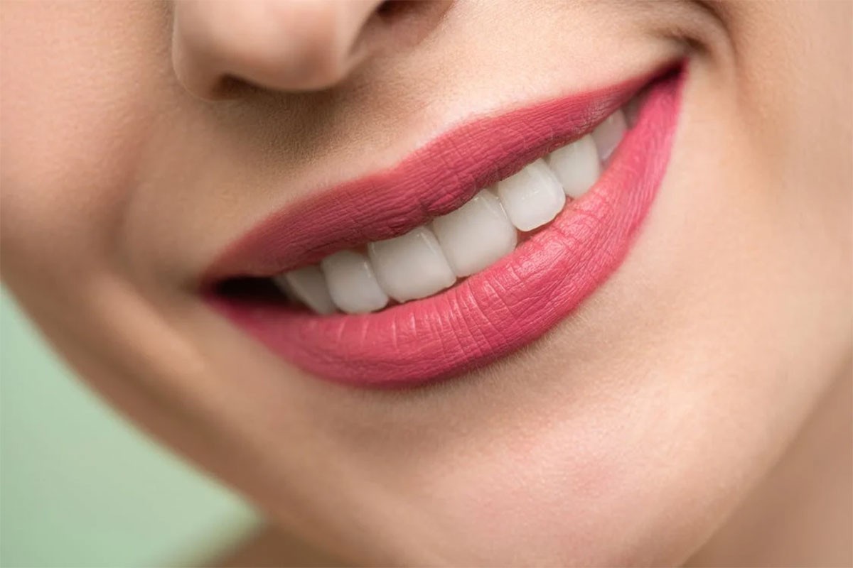 6 razloga zbog kojih zubi postaju žuti
