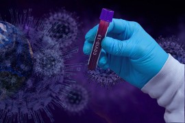 U Crnoj Gori 250 novih slučajeva virusa korona