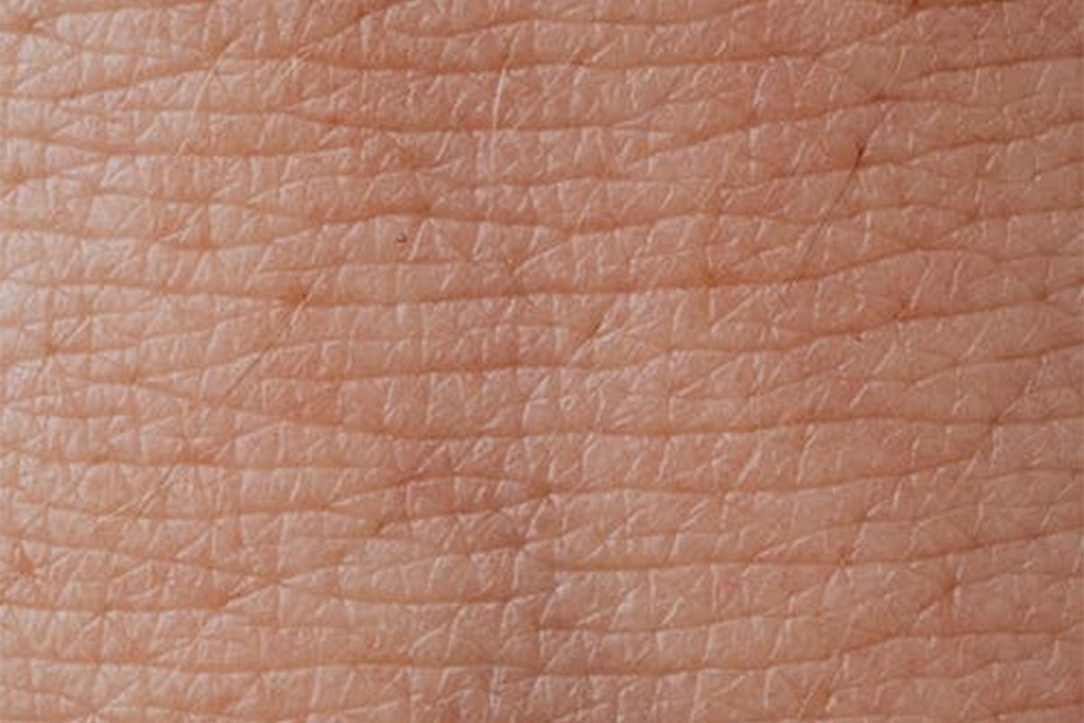 4 simptoma na koži znak da nemate dovoljno soli u organizmu