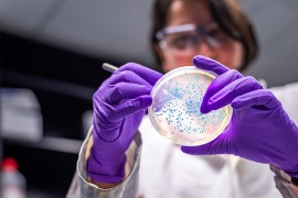 Hiljade nepoznatih virusa skriveno u genima mikroba