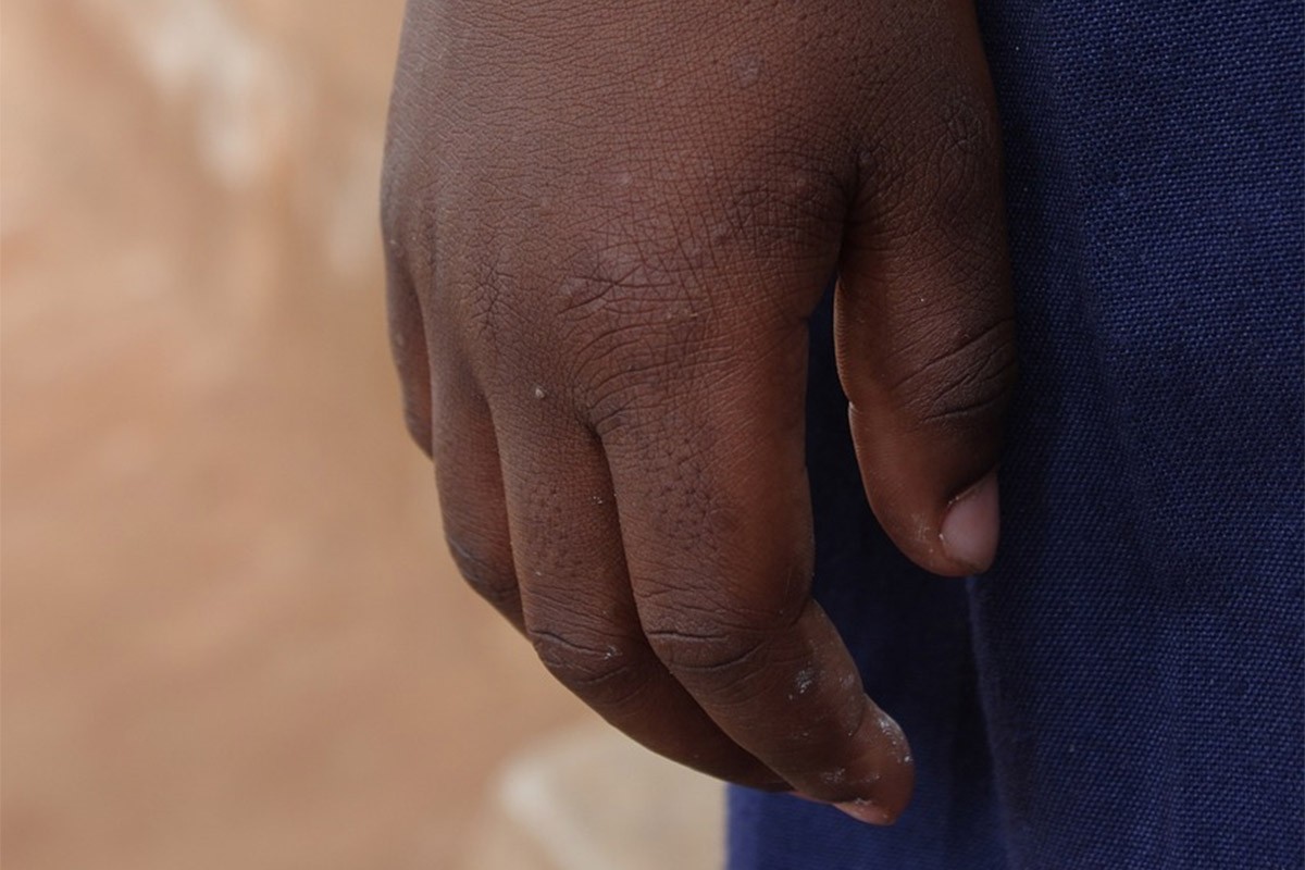Oko 300 djece spaseno iz sirotišta u Sudanu