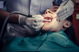 Koje stomatološke usluge su najskuplje?
