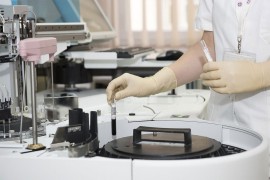Studija: Proteini u krvi mogu upozoriti na kancer sedam godina prije ...