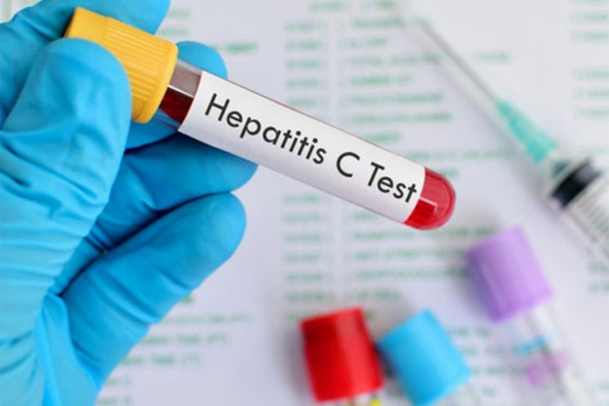 SZO: Iran je uzor drugim zemljama u pogledu kontrole hepatitisa C
