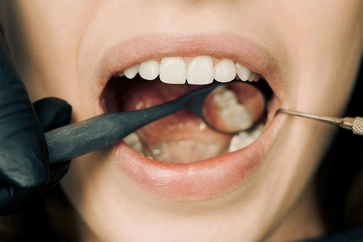 Naučnici razvijaju lijek koji će omogućiti ponovni rast zuba, evo kad se očekuje na tržištu