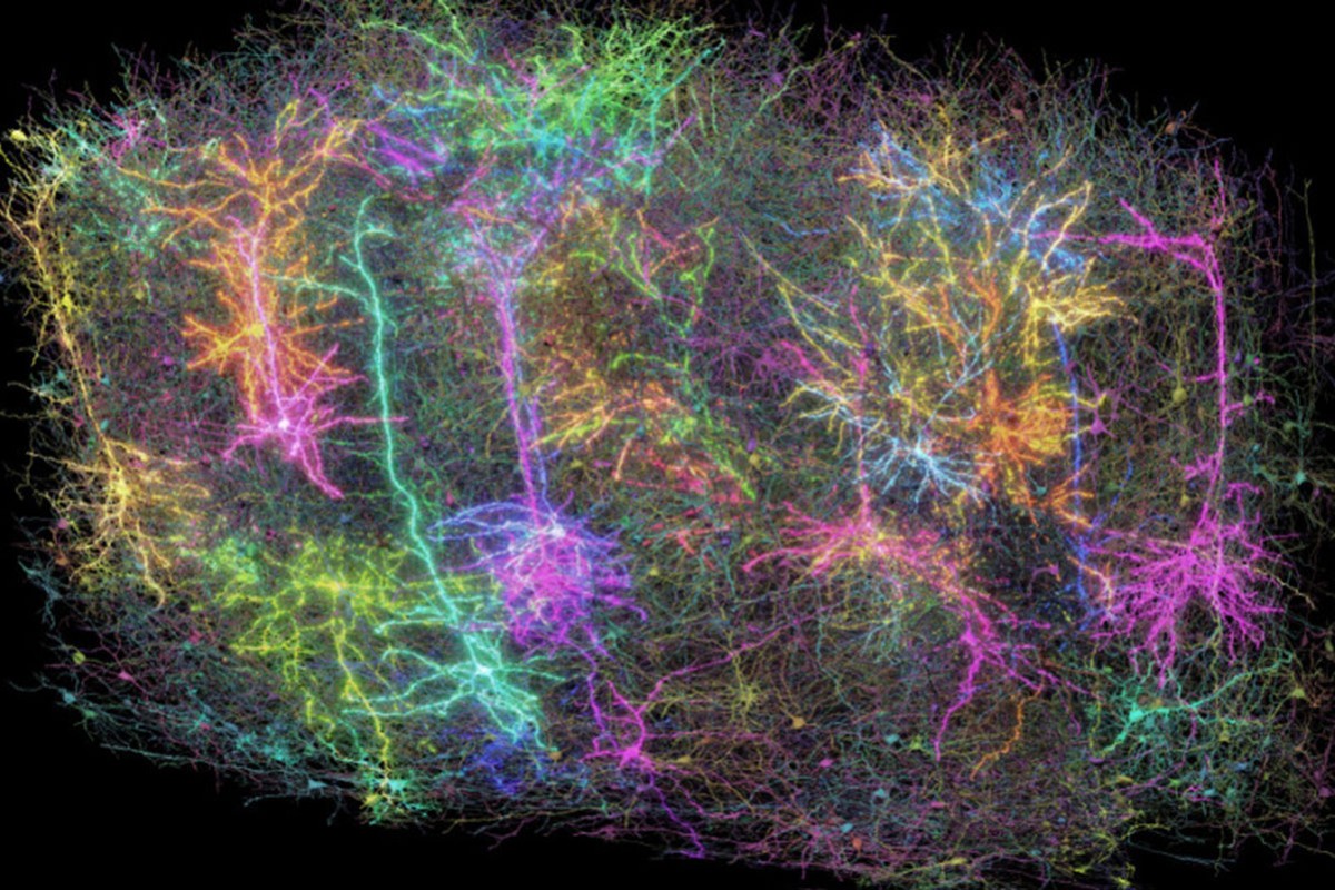 Najdetaljnija mapa mozga izgleda kao fotografija galaksije