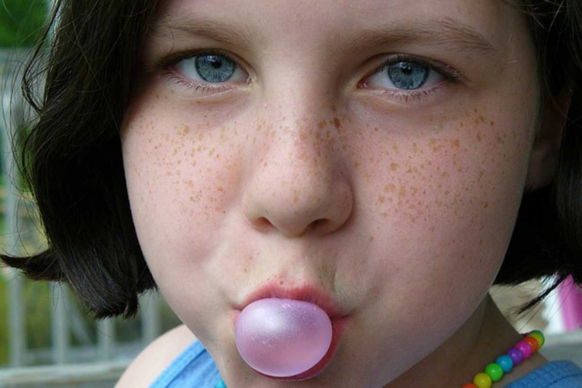 Šta su sunčane pjege i kako ih se riješiti?