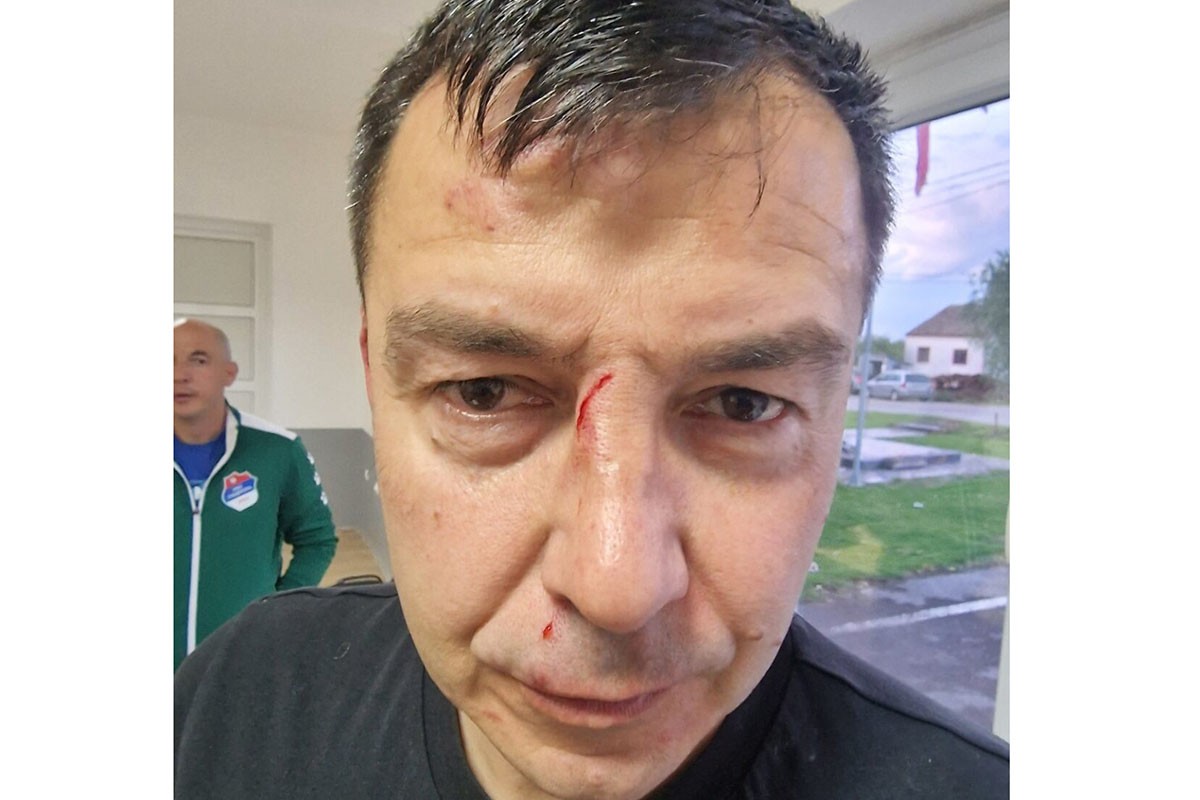 Uhapšene četiri osobe iz Laktaša: Sudiji slomili nos nakon fudbalske utakmice